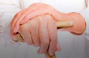dolore alle articolazioni delle dita con artrite reumatoide