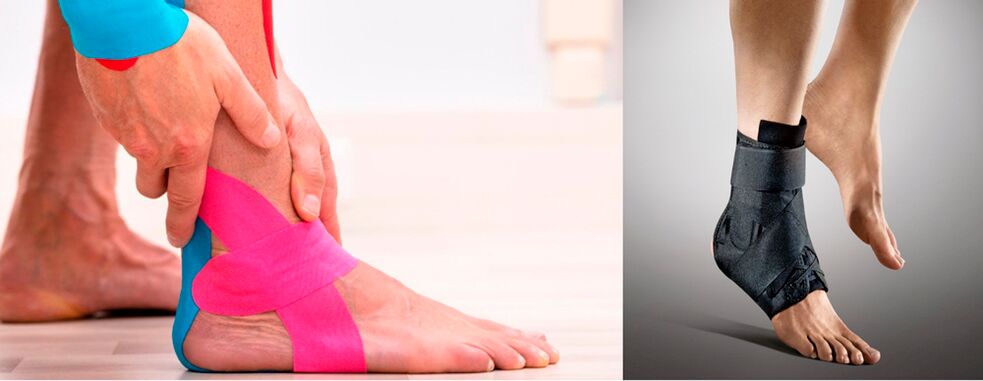 Ortesi e taping dell'articolazione della caviglia in caso di artrosi